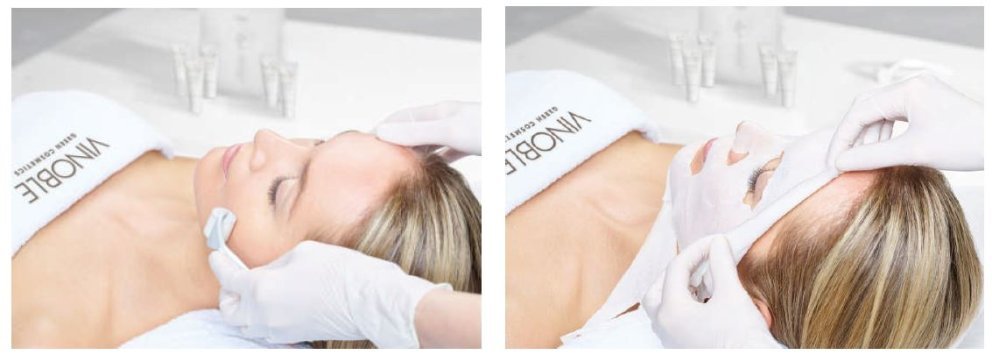 Vinoble Pro Youth Treatment Vinoble Pro Youth Treatment