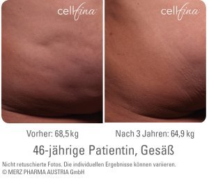 Vorher - Nachher Vorher - Nachher