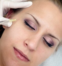 Face Shaping Novabel - Dr. Kiprov Face Shaping Novabel - Dr. Kiprov