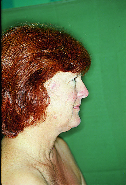 Gesicht Und Wirkung Beauty At