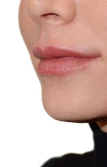 Lippenkorrektur Lippenkorrektur