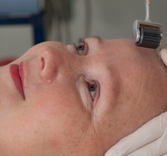 Skin Booster Skin Booster