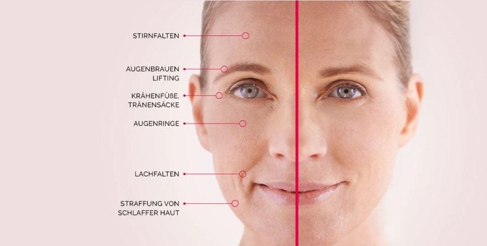 Instant Ageback Instant Ageback