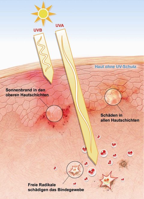Haut ohne UV-Schutz Haut ohne UV-Schutz