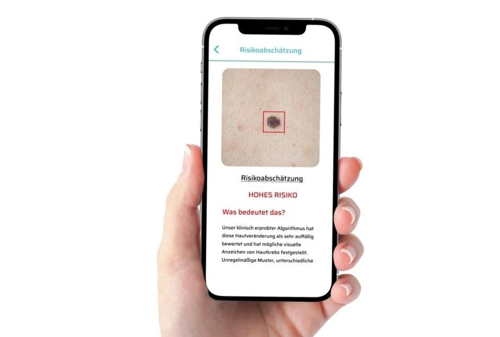 Bei erhöhtem Risiko sollte man umgehend einen Dermatologen aufsuchen. Bei erhöhtem Risiko sollte man umgehend einen Dermatologen aufsuchen.
