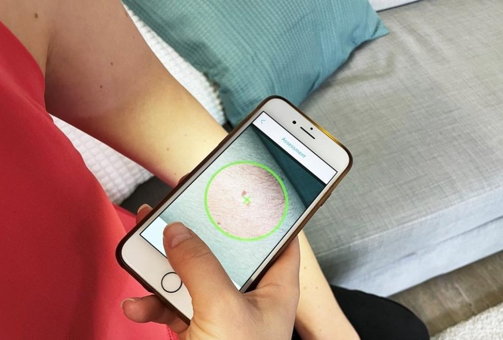 Mit der Handykamera wird aus 15cm Abstand ein Bild der betreffenden Hautstelle gemacht Mit der Handykamera wird aus 15cm Abstand ein Bild der betreffenden Hautstelle gemacht